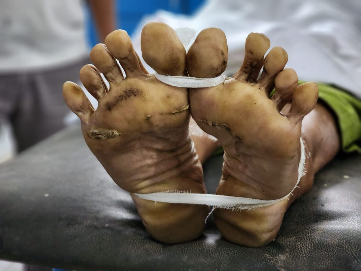Akibat Tersengat Arus Listrik, Karyawan PT Salim Ivomas Pratama Siswono Ditemukan Tergeletak Meninggal