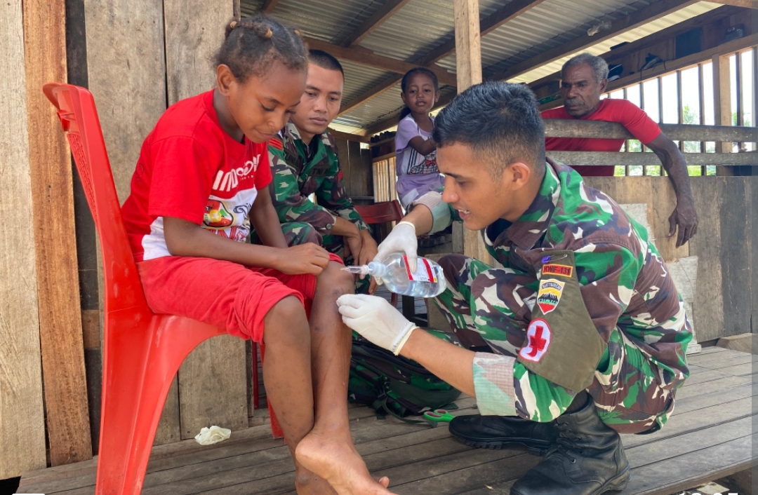 Kepedulian Satgas Yonif 131/Brajasakti Tangani Anak Sakit Di Perbatasan Papua