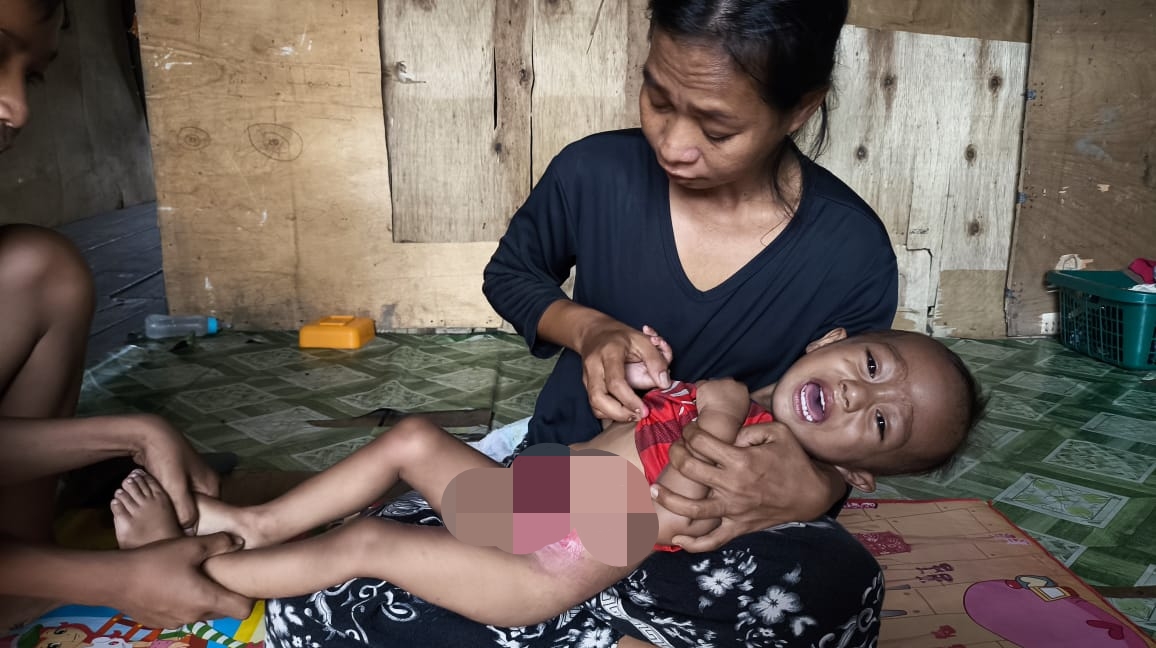 BAZNAS Rohil salurkan bantuan kepada keluarga  balita 1,8 tahun yang alami infeksi usus di ujung tanjung